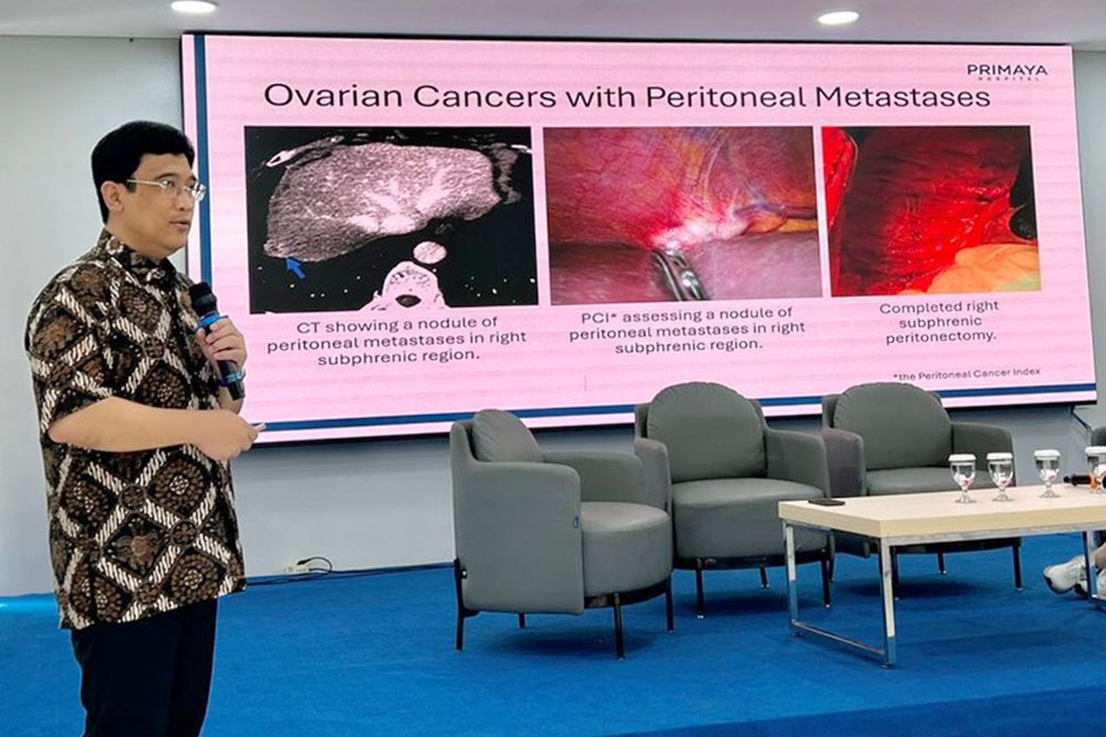 Tak Perlu ke Luar Negeri, Terapi HIPEC Hadir untuk Pasien Kanker Stadium Lanjut