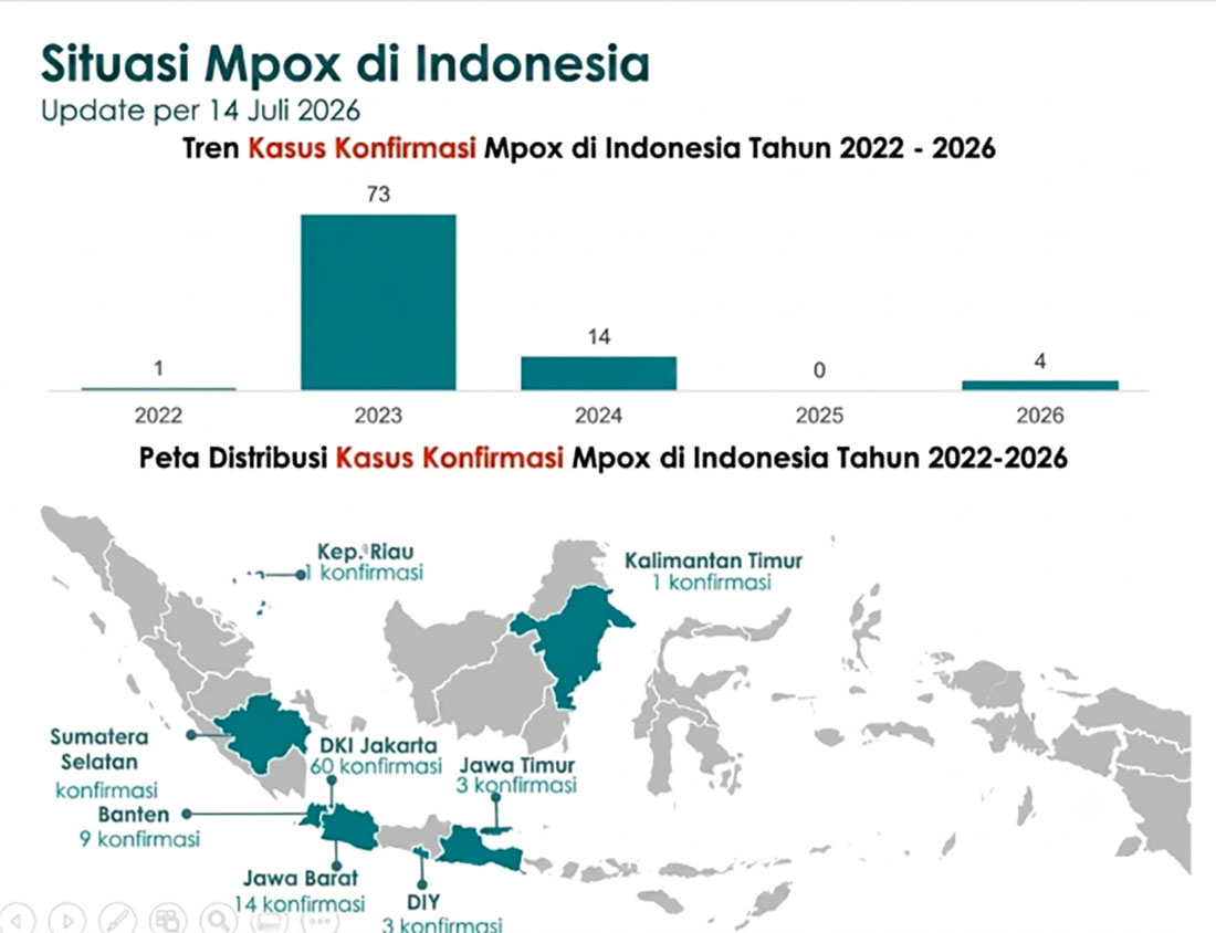 Kemenkes Beberkan Kondisi Terkini Kasus Mpox di Indonesia