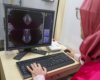 Deteksi Dini Kanker Payudara Kini Bisa Dilakukan dengan Mobil Mamografi