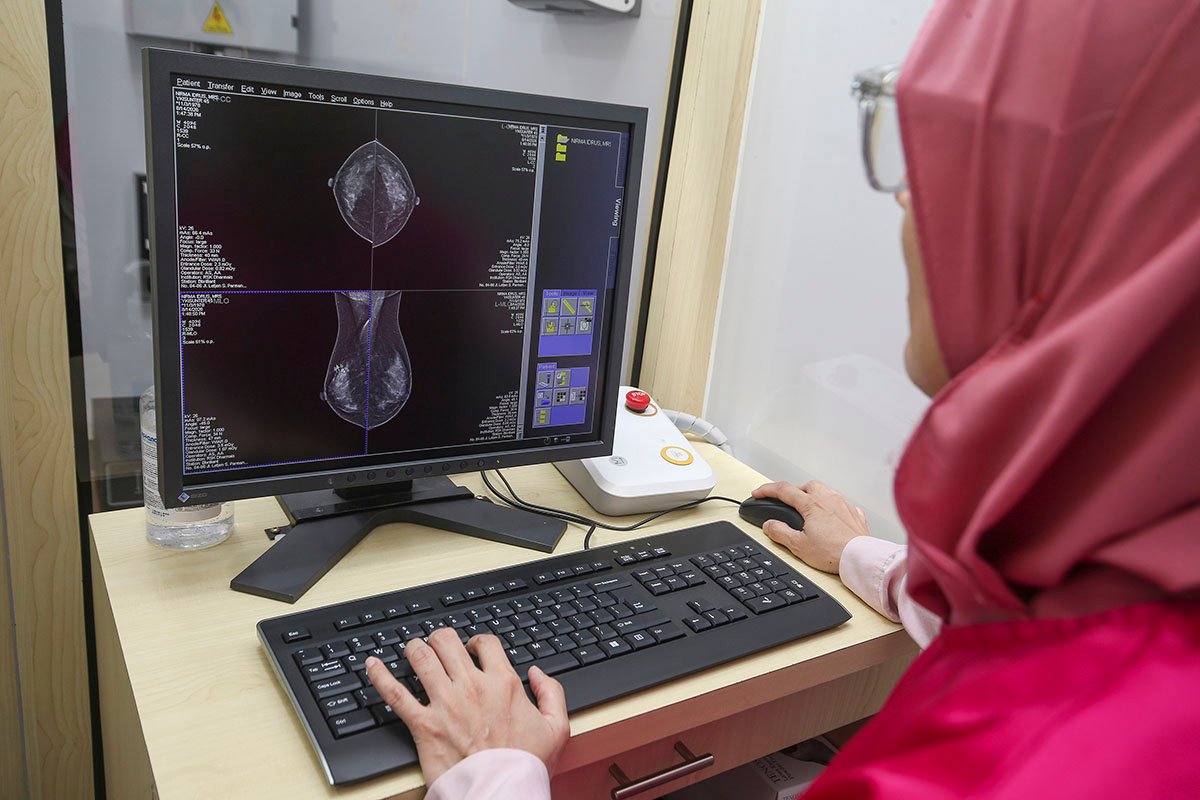 Deteksi Dini Kanker Payudara Kini Bisa Dilakukan dengan Mobil Mamografi